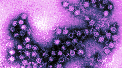 Què és un enterovirus?