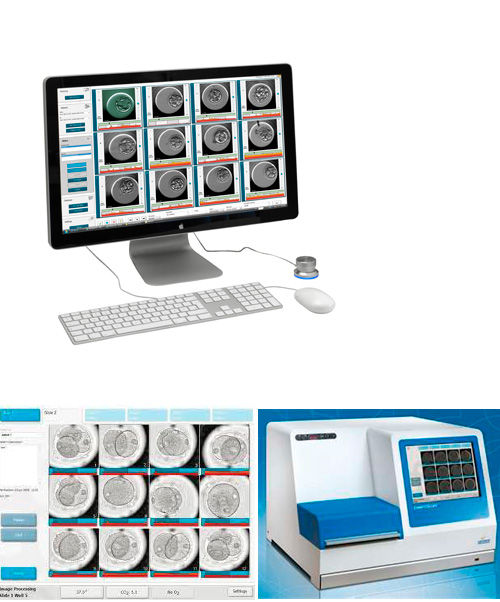 L'embryoscope, nova tecnologia puntera en reproducció assistida