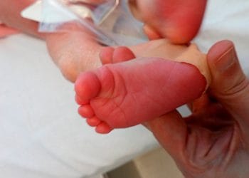 Cribratge neonatal a Catalunya: set casos d’hiperplàsia suprarenal congènita diagnosticats en nadons